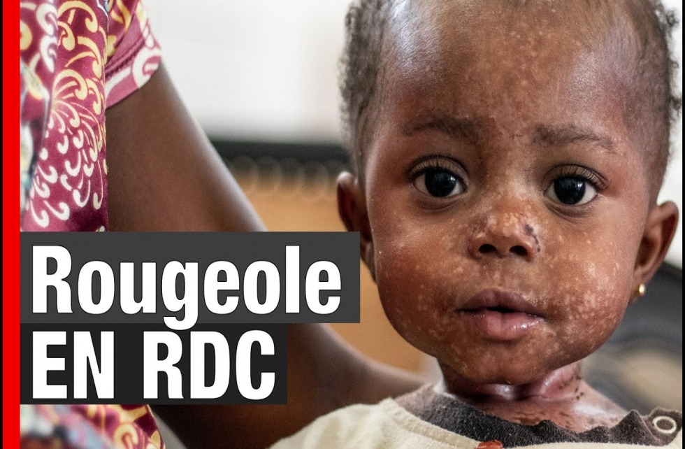 Rougeole en RDC